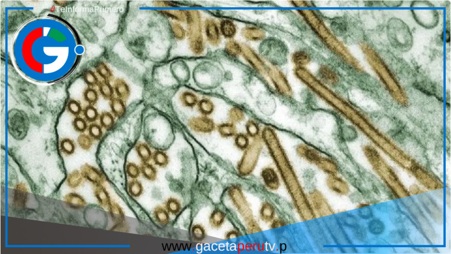 Cuatro personas infectadas con H5N1 en EE.UU.: OMS lanza alerta mundial