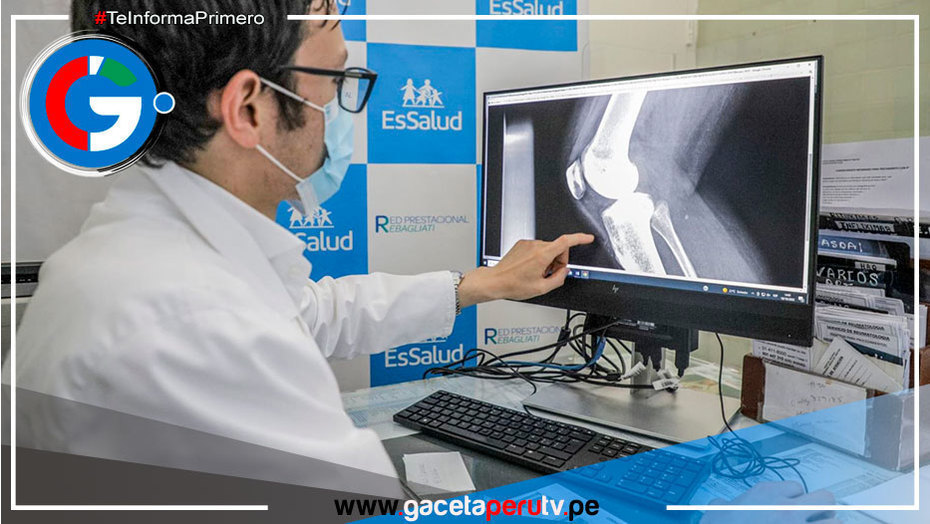 Realizan más de 80,000 atenciones a pacientes con osteoporosis a nivel nacional 
