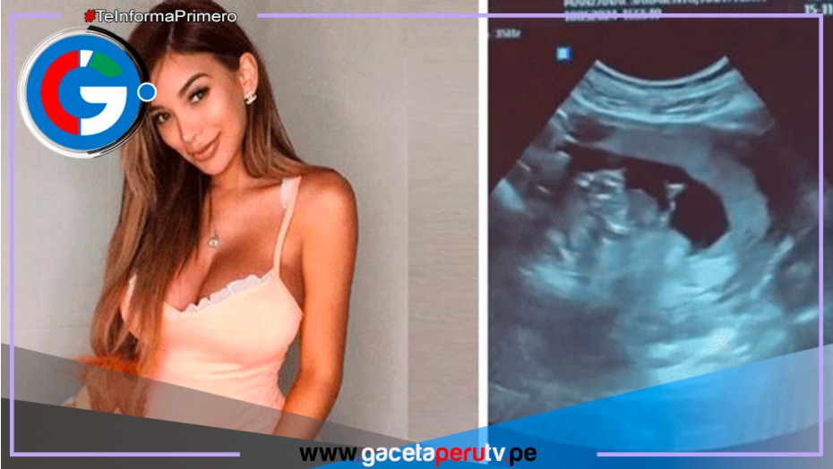 Paula Manzanal sorprende con la noticia de su embarazo: ¡será mamá por segunda vez!