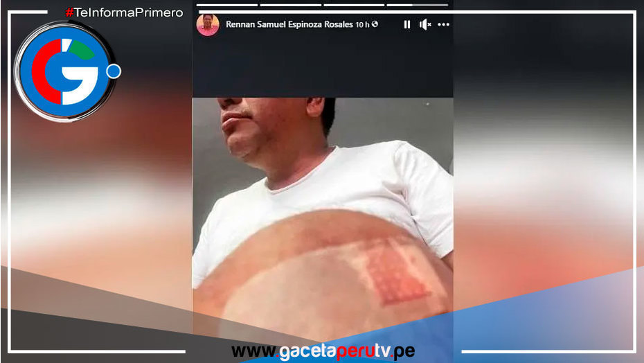 Rennan Espinoza sale ileso de accidente y desata controversia por su actuación posterior